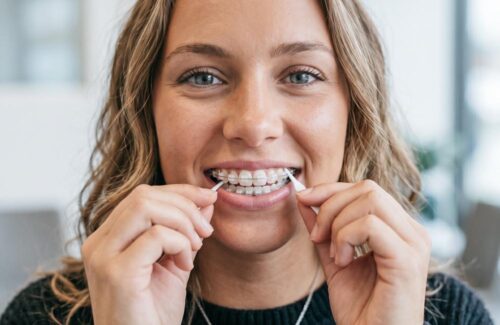 Blog 04 500x325