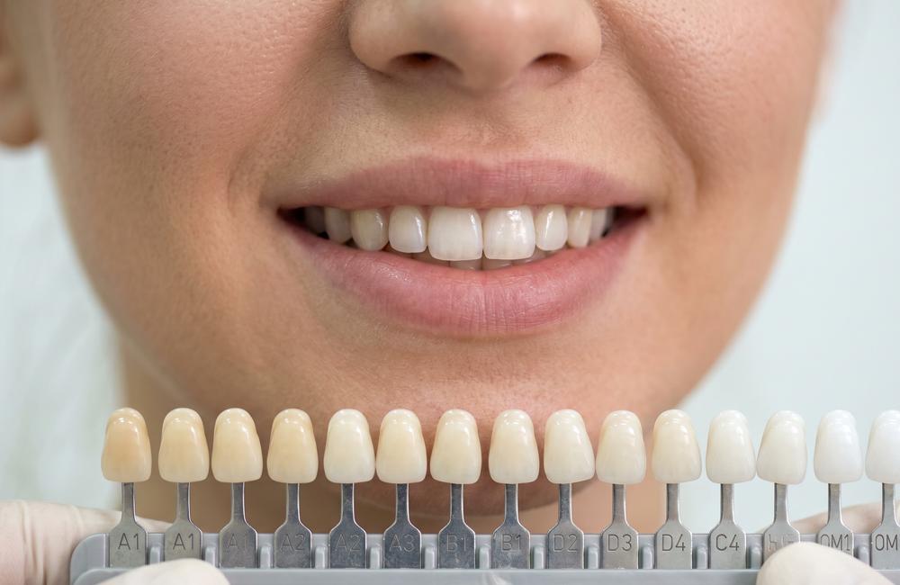 How Digital Dentistry Is Changing Prosthetic Treatments Blog 07