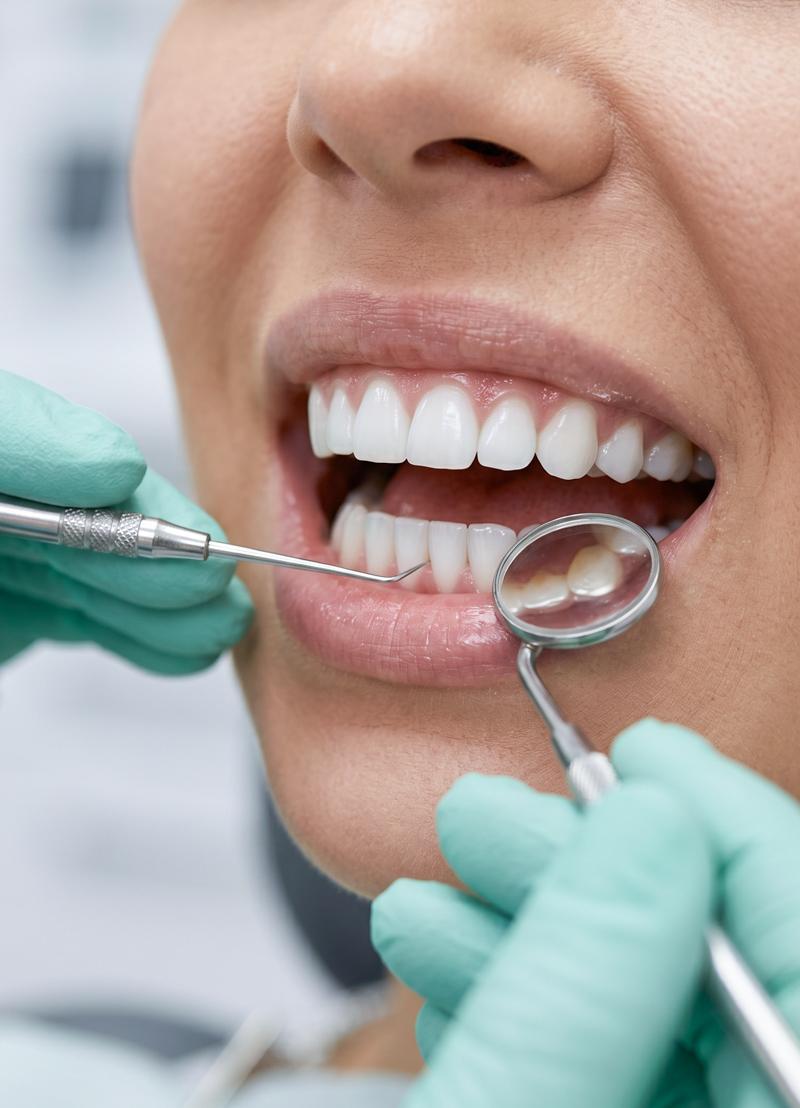 Dental Examination Service 04 3